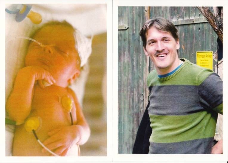 Man sieht zwei Farbfotos nebeneinander. Das linke Bild zeigt ein Neugeborenes im Krankenhausbettchen angeschlossen an Sauerstoffschlauch und Herz-Kreislauf-Überwachung. Das rechte Bild zeigt einen jungen Mann vor einer Scheunentür.